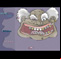 Le Casse Dents